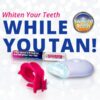 Twilight Teeth UV Whitening - Image 2